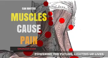 How Muscle Knots Cause Pain and Discomfort