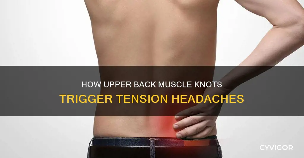 can knotted muscles in your upper back cause tension headaches