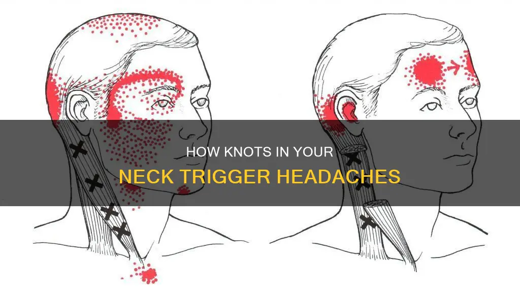 can knotted neck muscles cause headaches