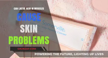 Lactic Acid: Skin Problems Triggered by Muscle Build-up?