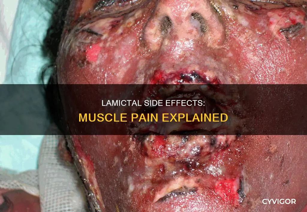 can lamictal cause muscle pain