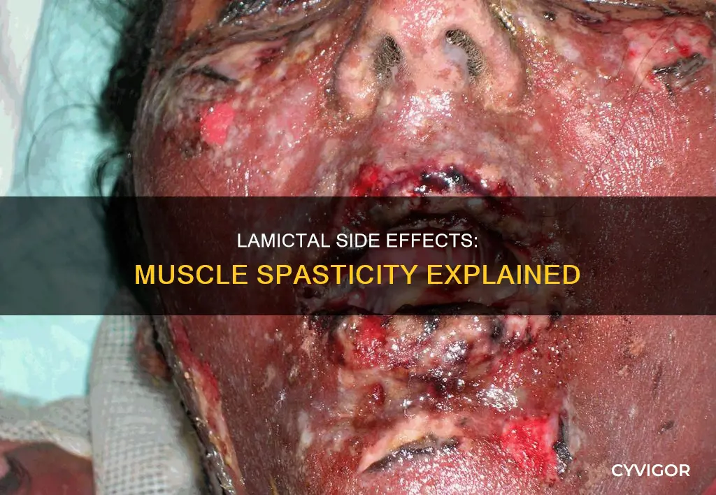 can lamictal cause muscle spasticity