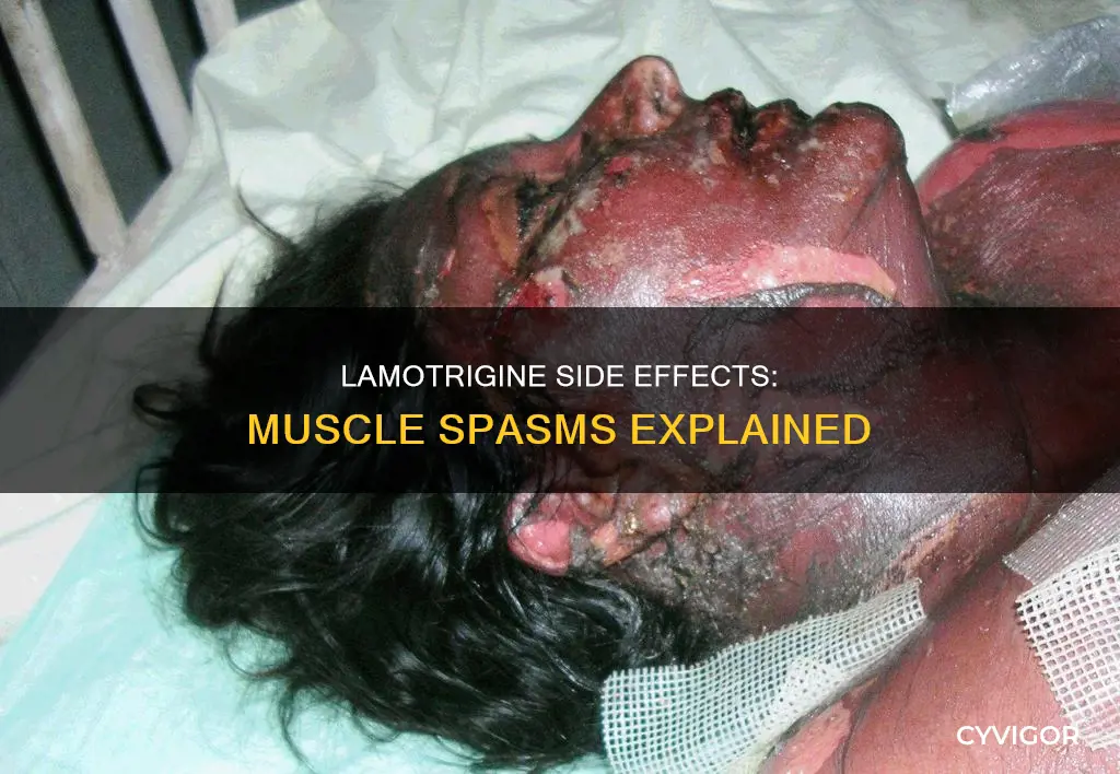 can lamotrigine cause muscle spasms