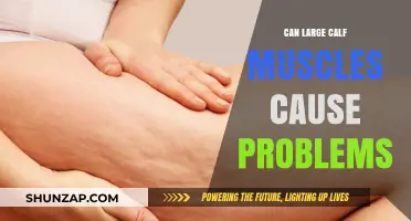 Large Calf Muscles: Hindrance or Help?