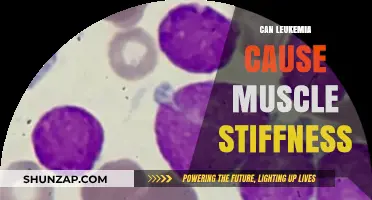 Leukemia and Muscle Stiffness: Is There a Link?