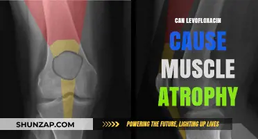 Levofloxacin's Link to Muscle Atrophy: What You Need to Know