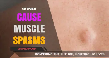 Lipomas and Muscle Spasms: Is There a Connection?