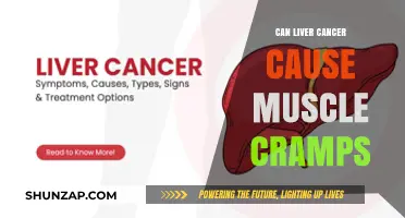 Liver Cancer and Muscle Cramps: Is There a Link?