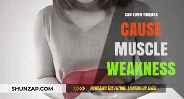 Liver Disease: Muscle Weakness and Fatigue
