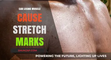 How Muscle Loss Leads to Stretch Marks