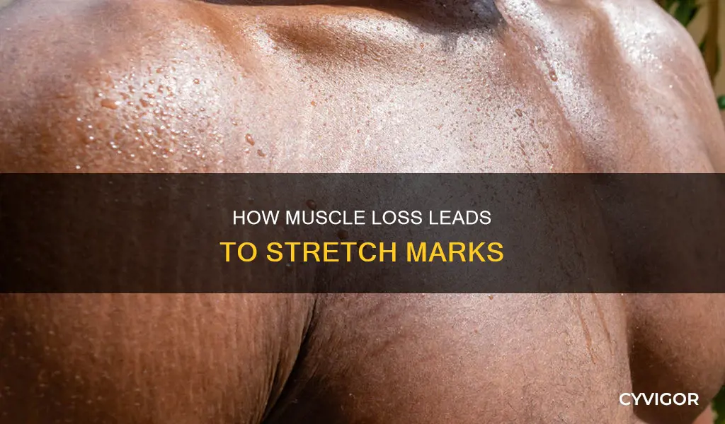 can losing muscle cause stretch marks