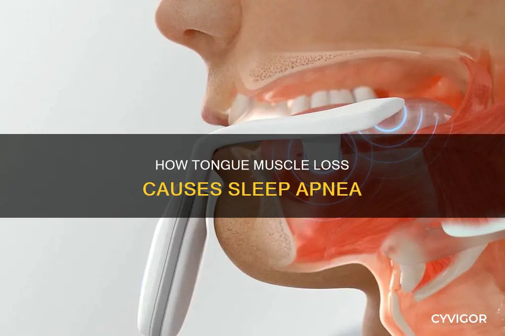 can lost of tounge muscle can cause sleep apnea