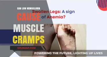 How Hemoglobin Deficiency Triggers Muscle Cramps