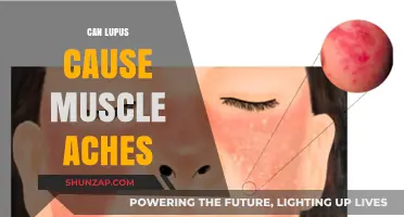 Lupus and Muscle Aches: What's the Connection?