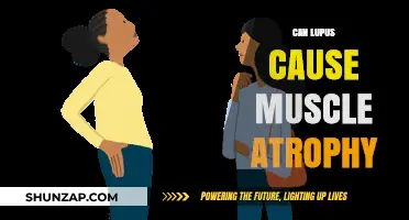 Lupus and Muscle Atrophy: Understanding the Link