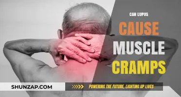 Lupus and Muscle Cramps: What's the Link?