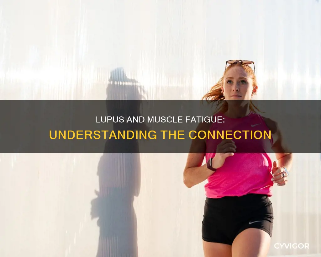 can lupus cause muscle fatigue