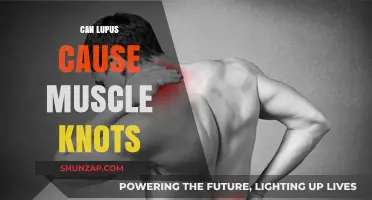 Lupus and Muscle Knots: What's the Connection?