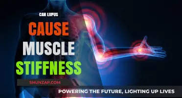 Lupus and Muscle Stiffness: Is There a Link?