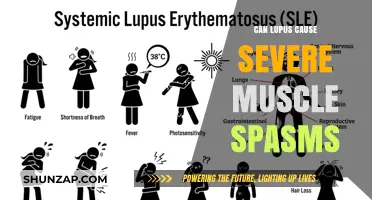 Lupus and Muscle Spasms: What's the Connection?
