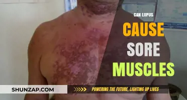 Lupus and Sore Muscles: What's the Connection?