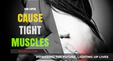 Lupus and Muscle Tightness: What's the Connection?