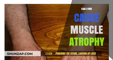 Lyme Disease: Muscle Atrophy and Treatment