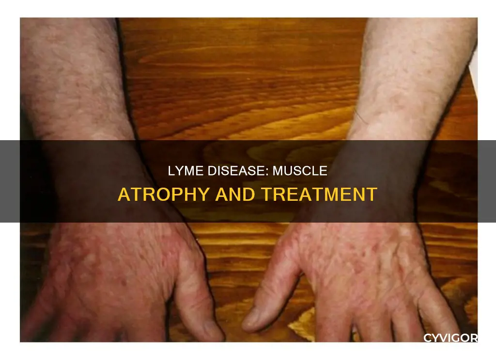 can lyme cause muscle atrophy