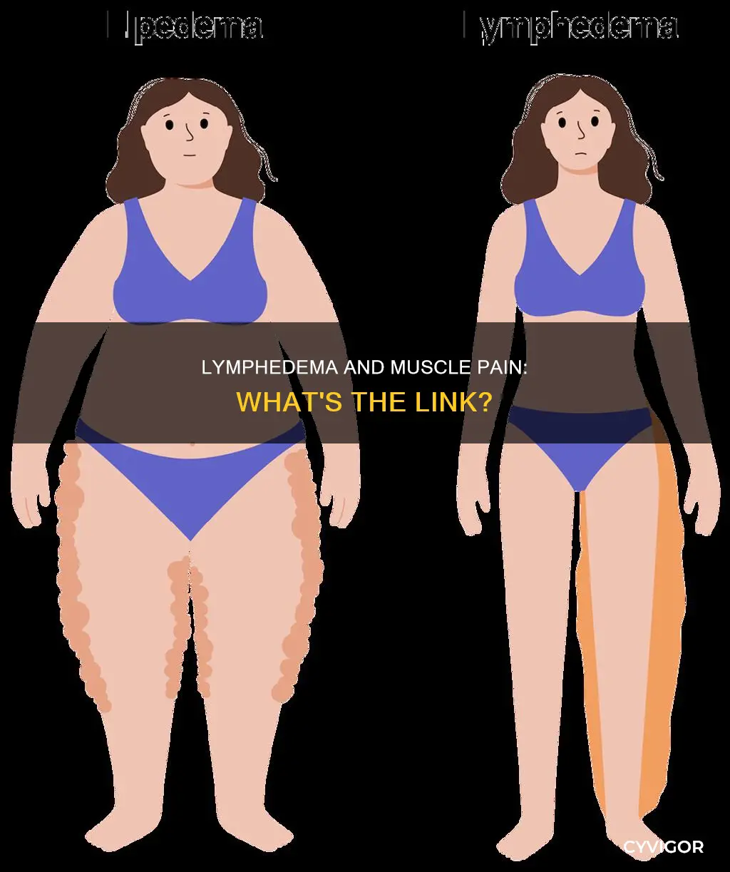 can lymphedema cause muscle pain