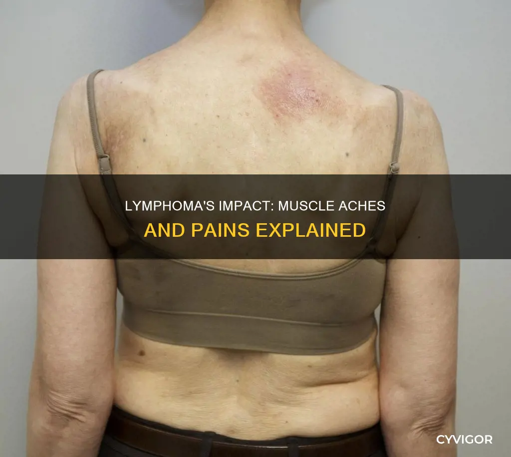 can lymphoma cause muscle aches