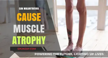 Malnutrition's Impact: Muscle Atrophy and Malnourishment