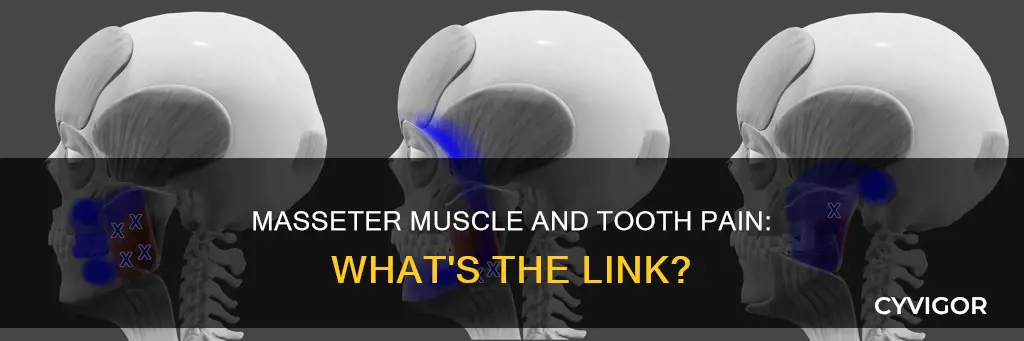can masseter muscle cause tooth pain