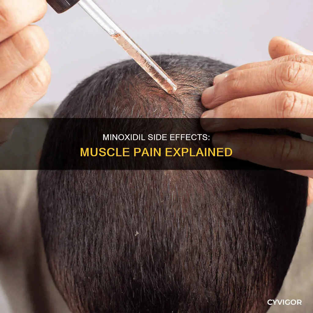 can minoxidil cause muscle pain