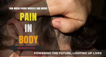 MRSA: Muscle and Nerve Pain Culprit?