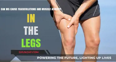 MS and Leg Issues: Fasciculations and Atrophy