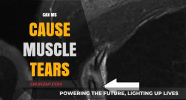Muscle Tears and MS: What's the Link?