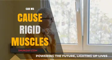 MS and Muscle Rigidity: What's the Link?