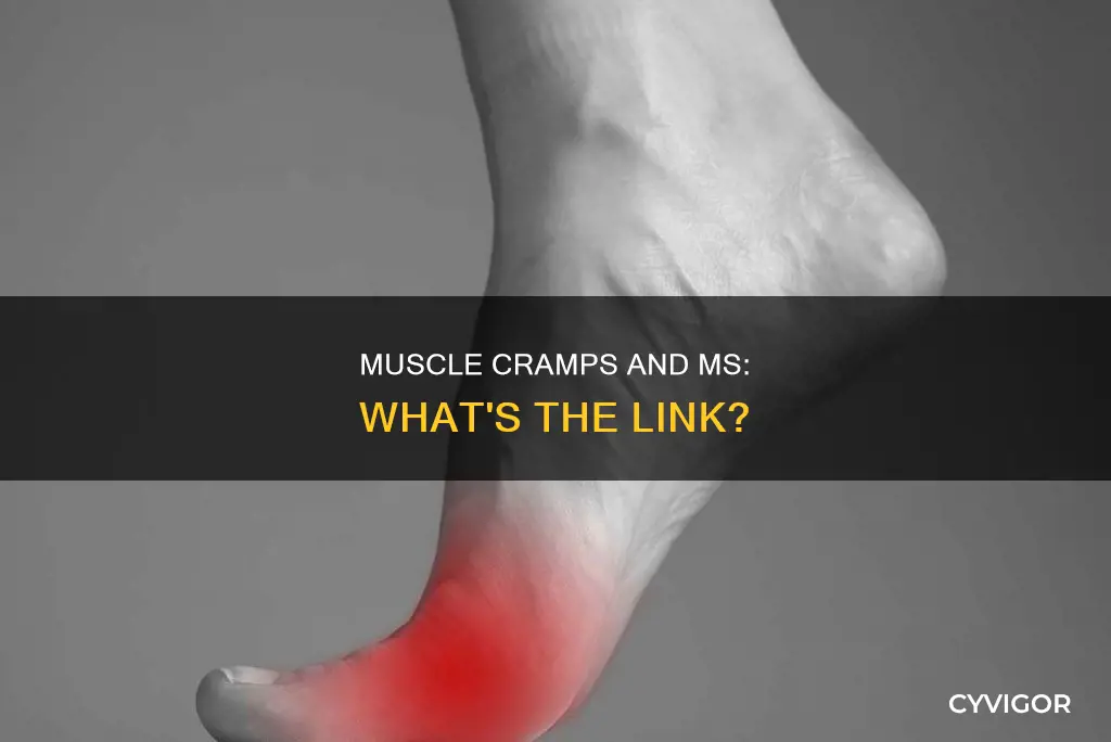 can ms cause severe muscle cramps in foot arch