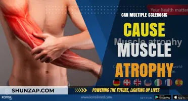 Muscle Atrophy and Multiple Sclerosis: What's the Link?