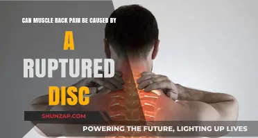 Back Pain and Ruptured Discs: What's the Link?