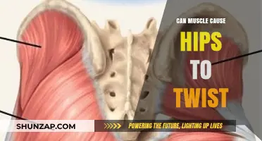 Muscle Imbalance: Hip Twisting and What to Do About It