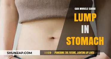 Muscle or Lump: What's That Stomach Bulge?