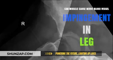 Muscle Impingement: Leg Nerve and Blood Vessel Compression