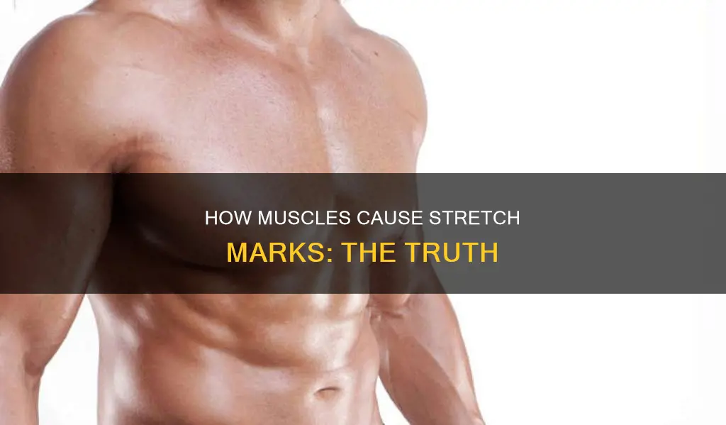 can muscle cause stretch marks
