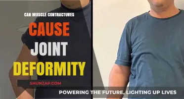 Muscle Contractures: Joint Deformity's Root Cause?
