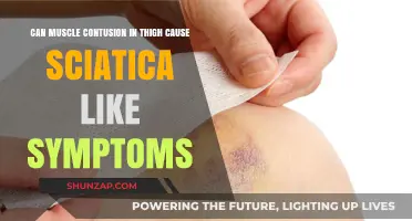 Muscle Contusion: Thigh Pain and Sciatica Symptoms