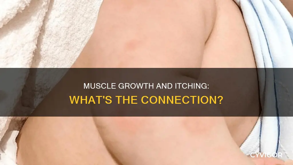 can muscle growth cause itching