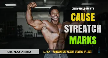 How Muscle Growth Causes Stretch Marks