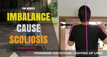 Muscle Imbalance: A Cause of Scoliosis?