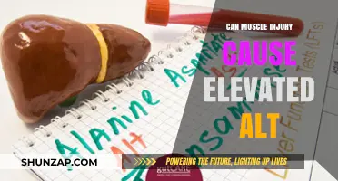 Muscle Injury: Can It Cause Elevated ALT Levels?